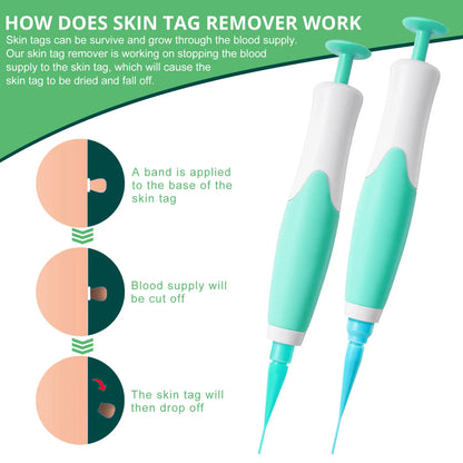 Band Painless Mole Wart Skin Tag Remover